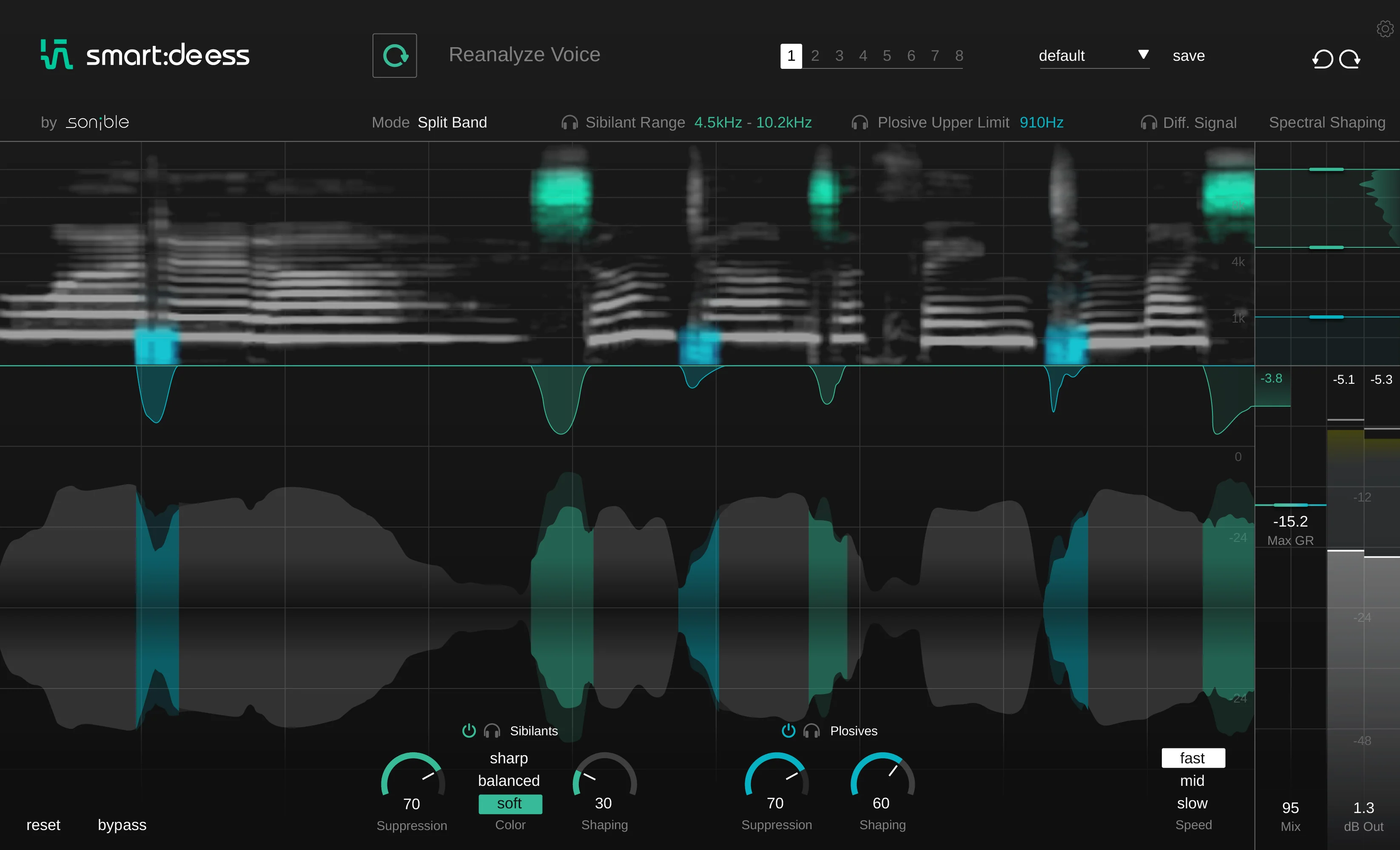 Sonible smart:deess: De-esser Plugin - Image 2